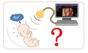 3dエコーで赤ちゃんの顔をみるのはダメ 榊原記念病院 産婦人科